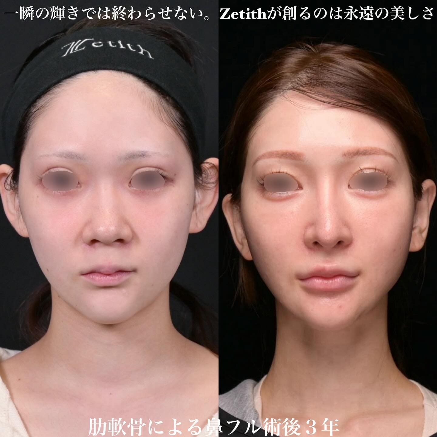 症例写真1