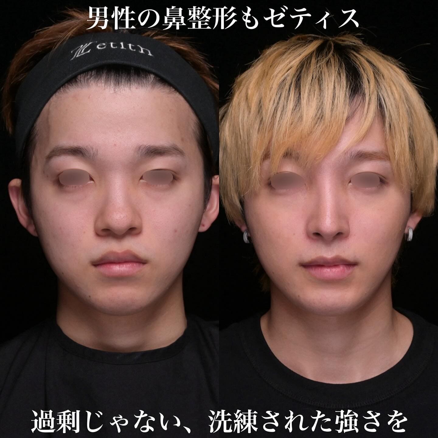 症例写真1