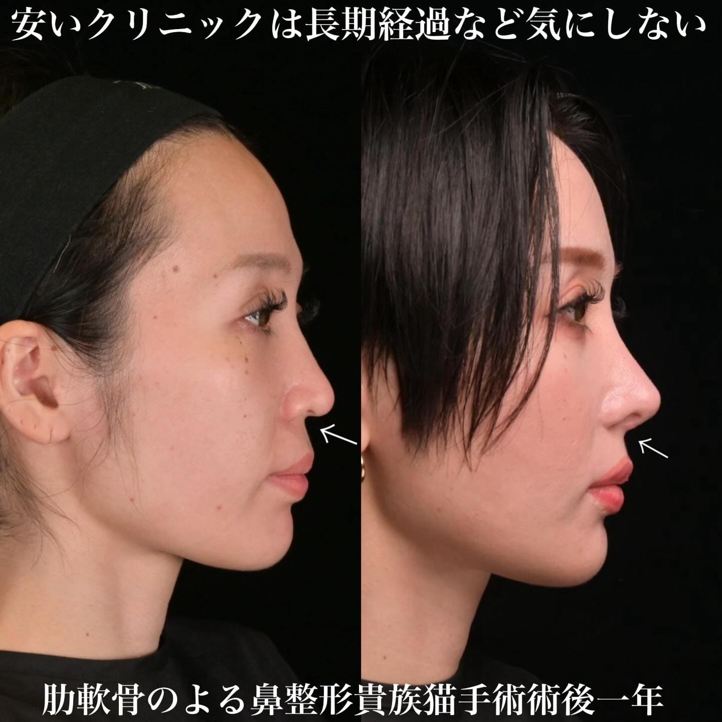 症例写真2