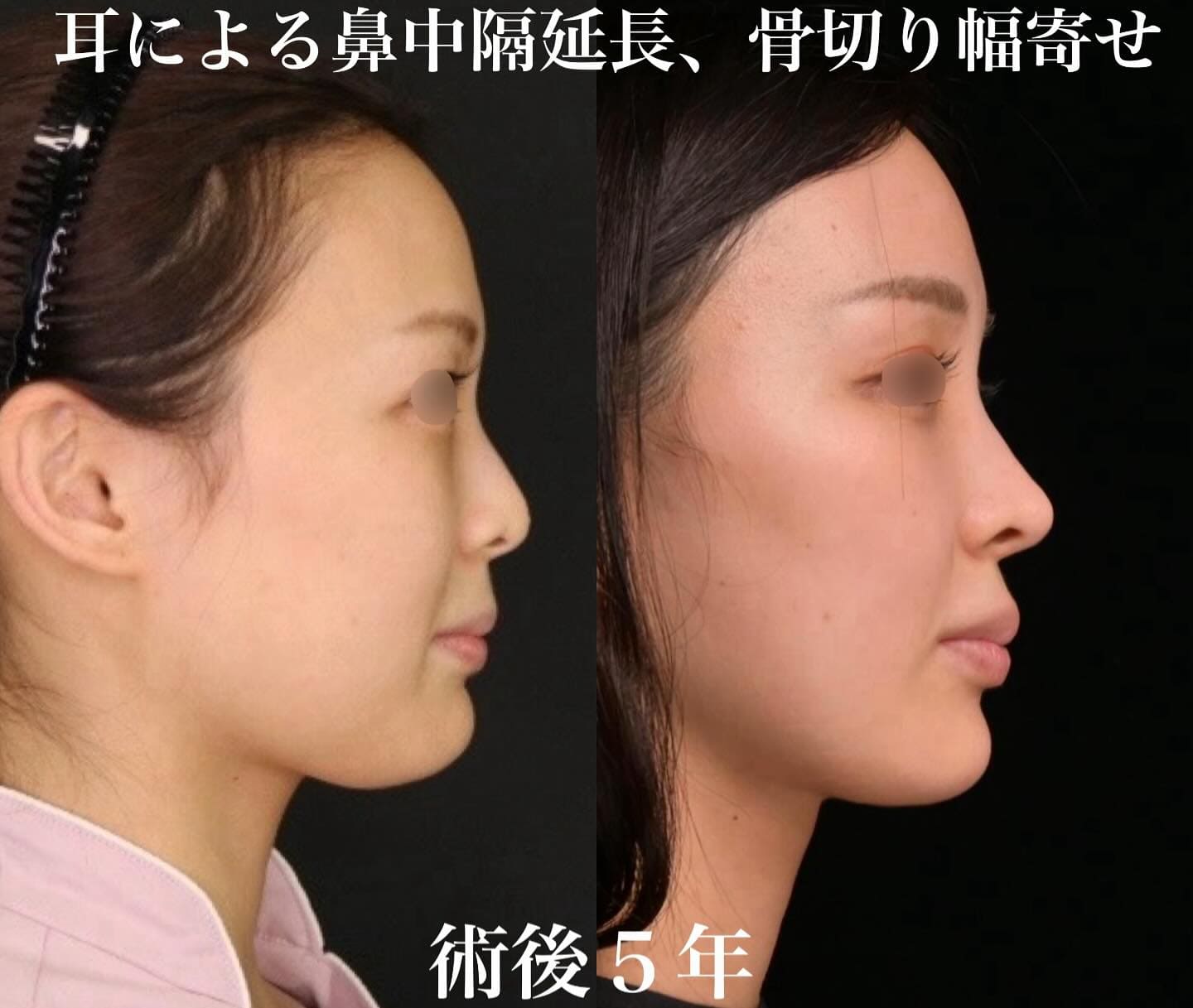 症例写真2