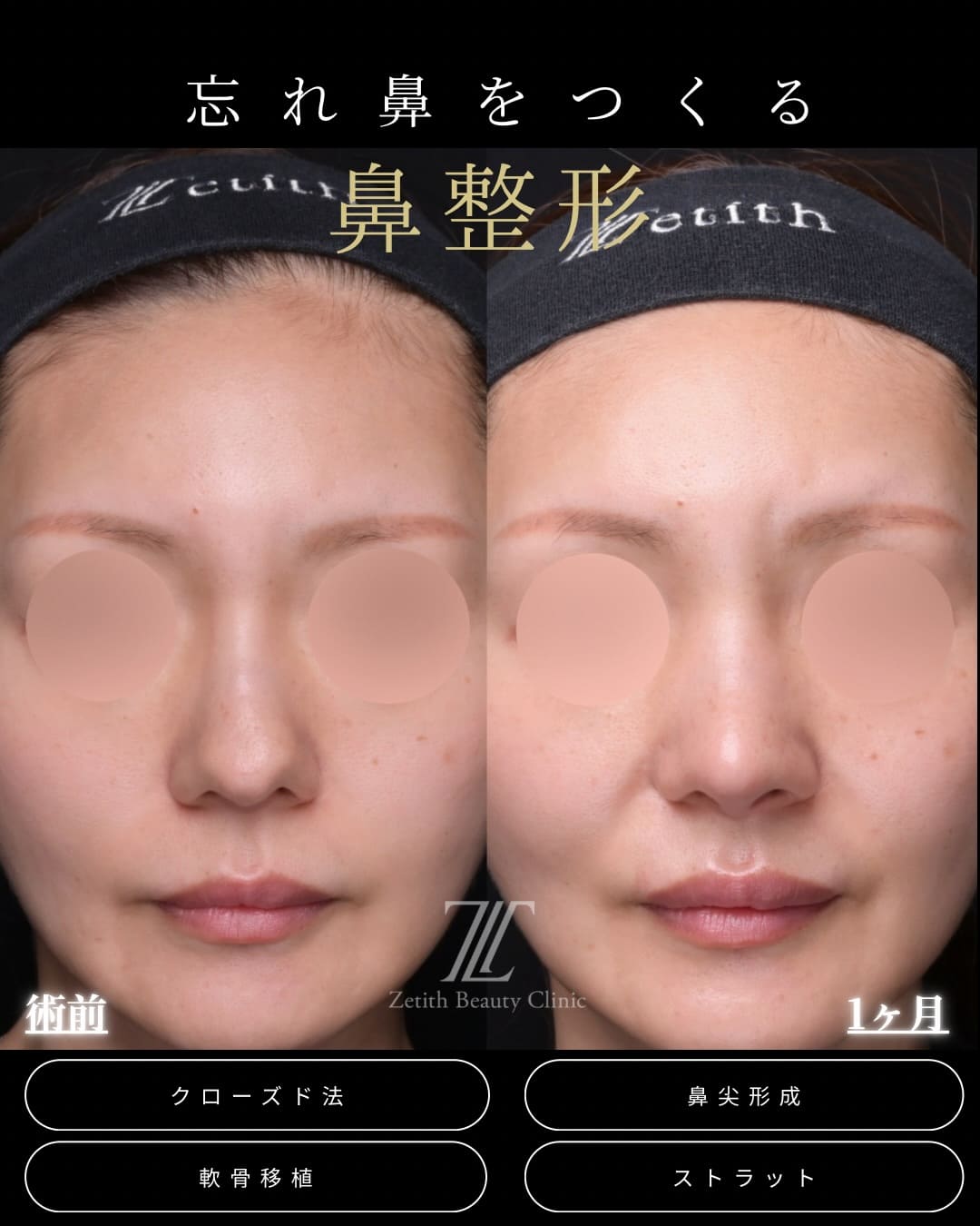 症例写真1