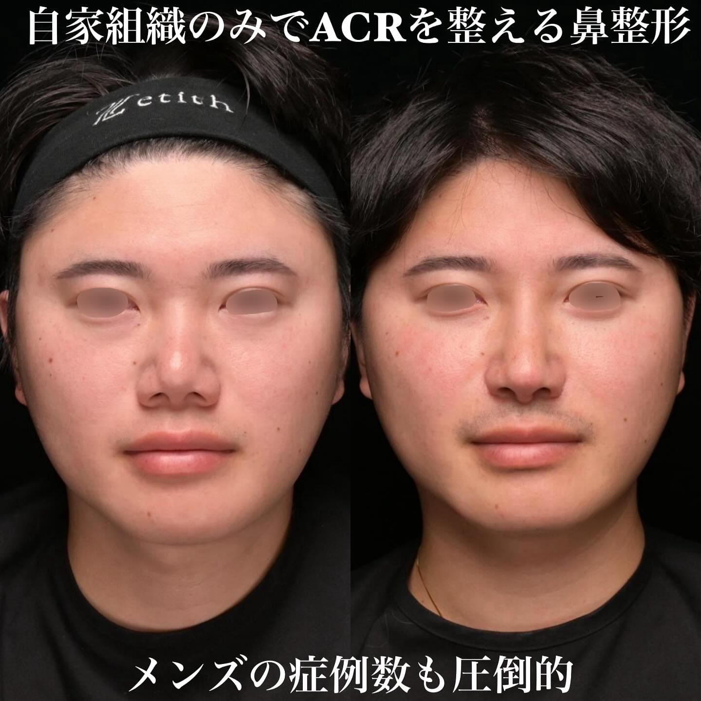 症例写真1
