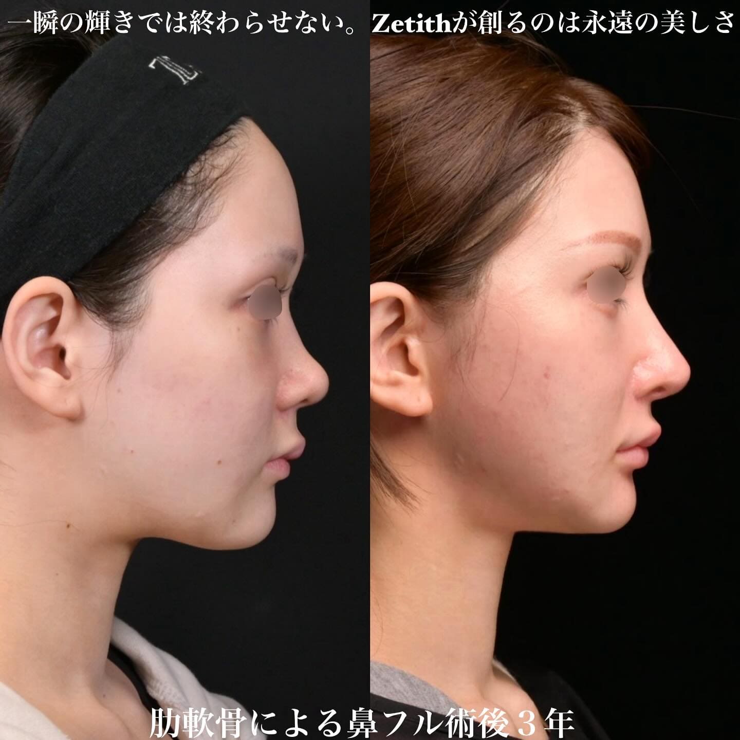 症例写真2