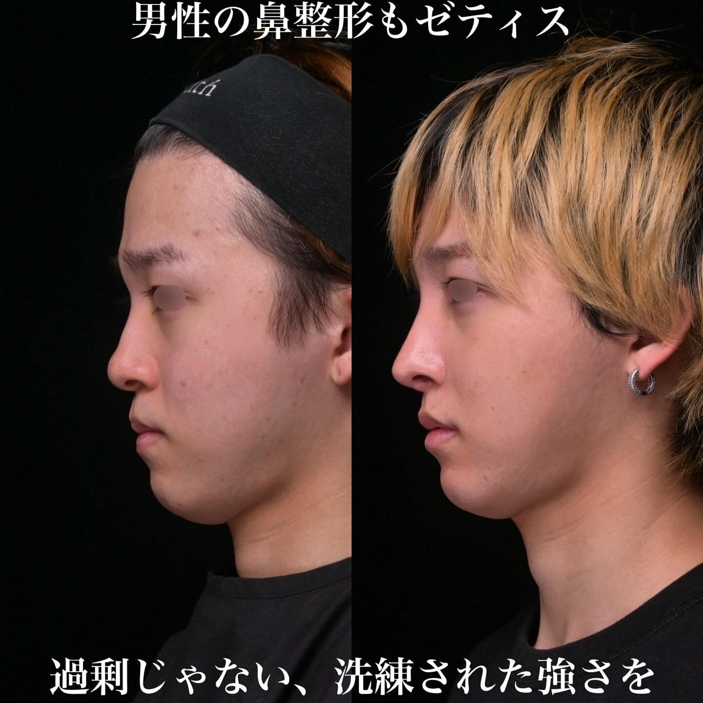 症例写真2