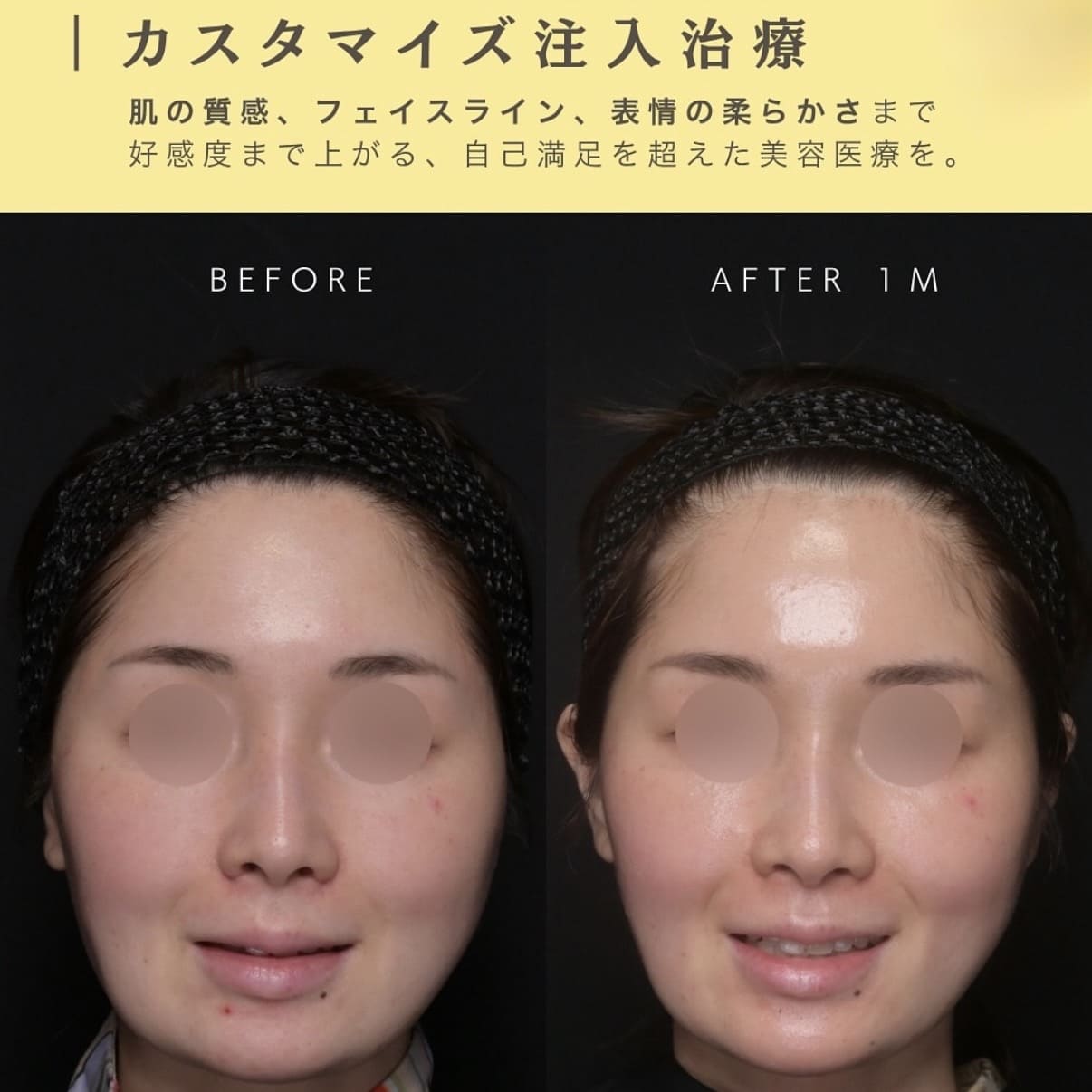 複合施術