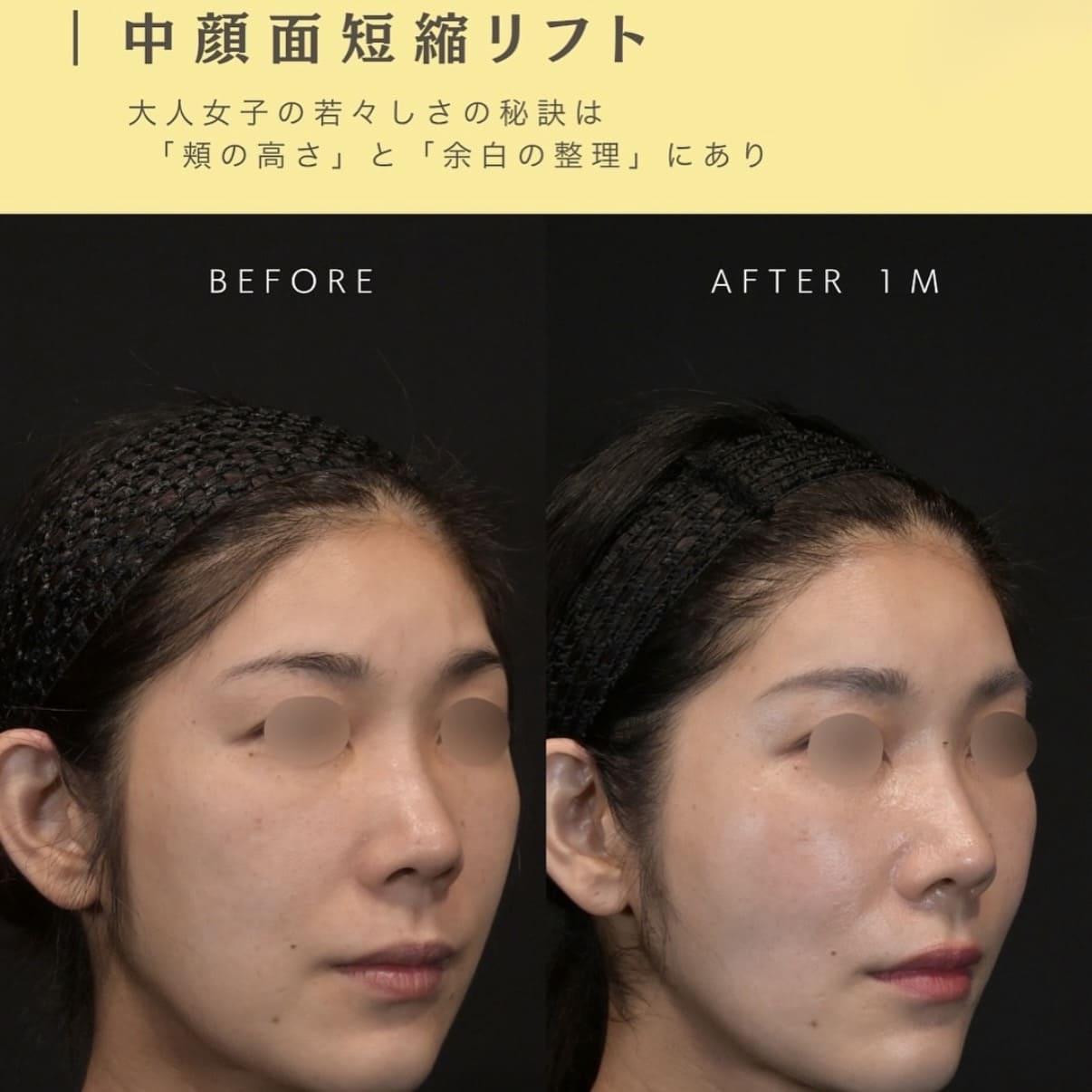複合施術