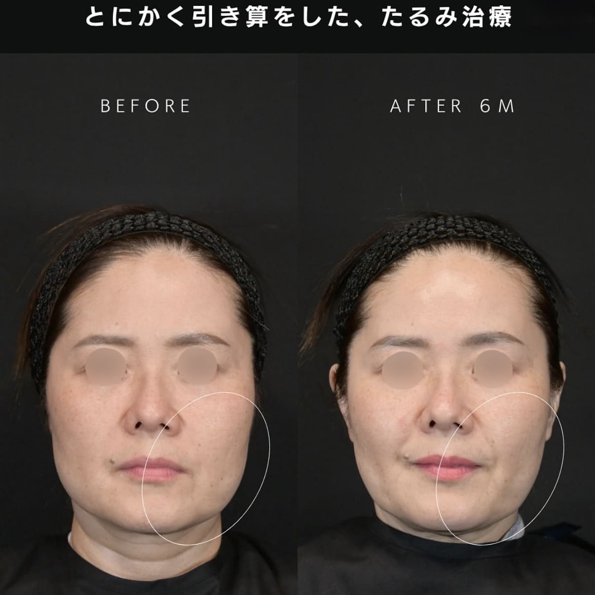 複合施術