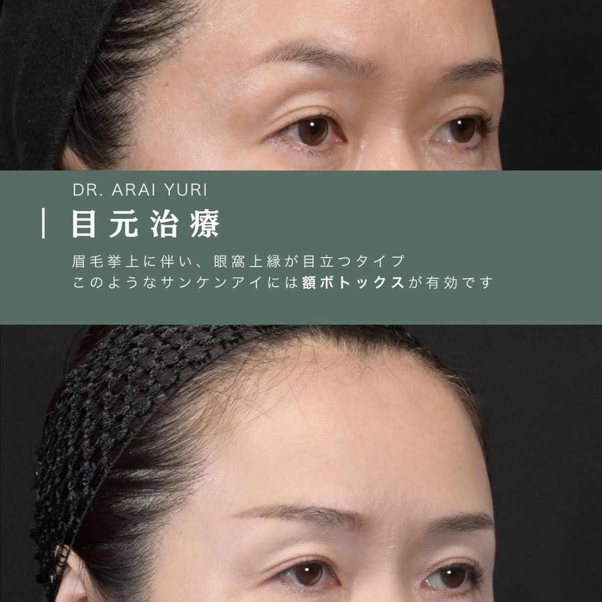 目元治療