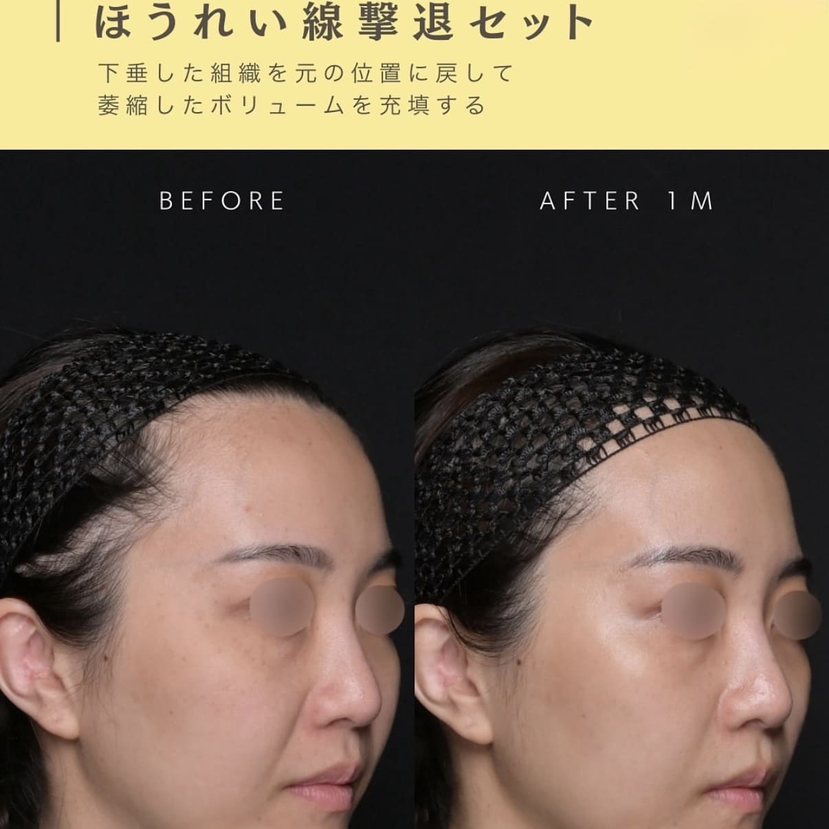 複合施術