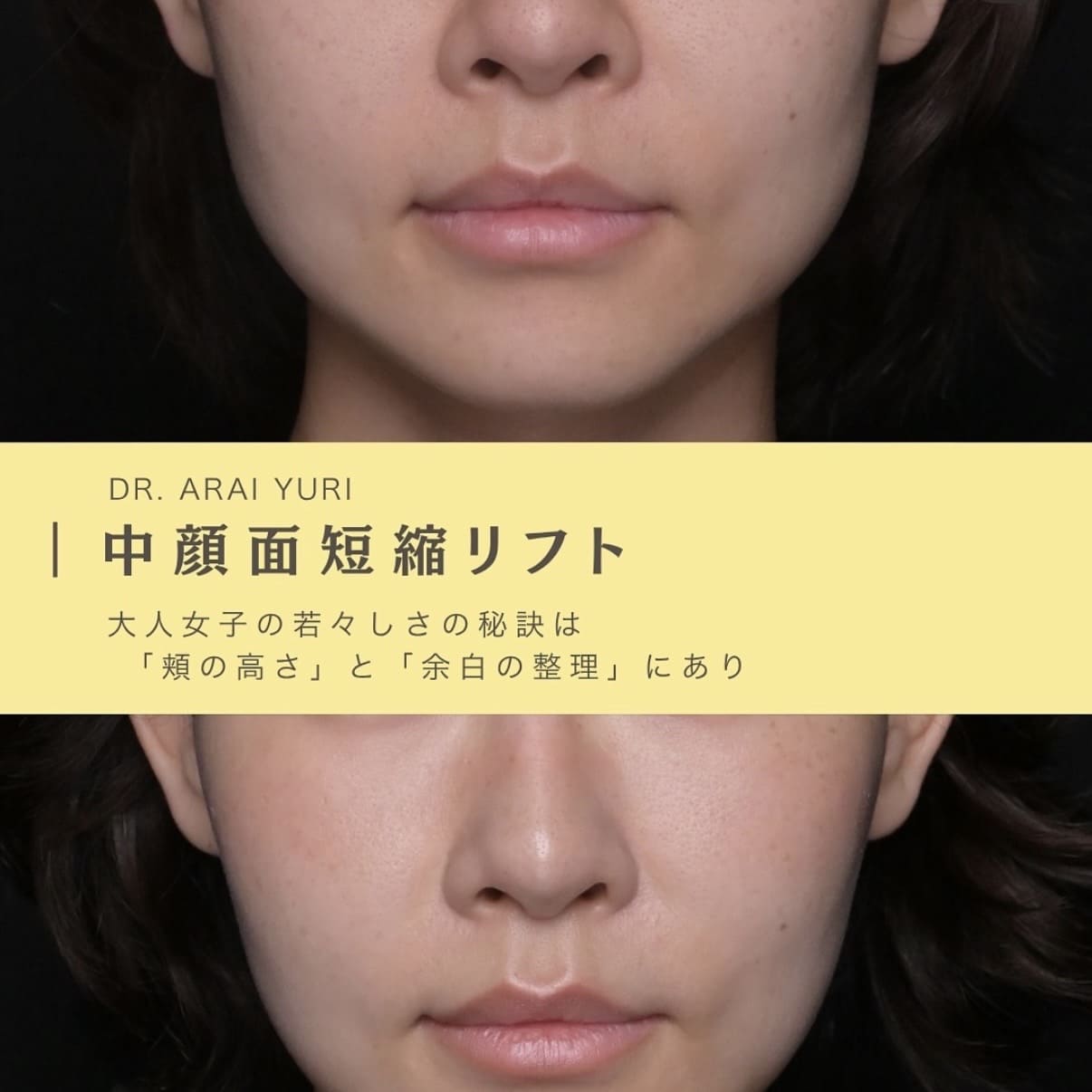 複合施術
