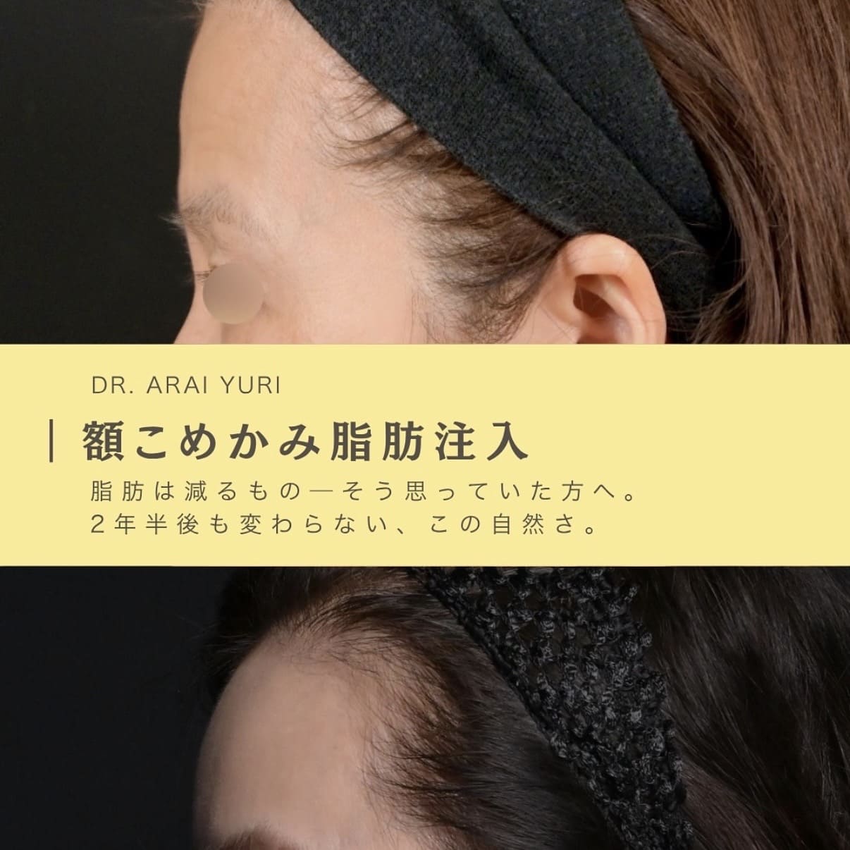 複合施術