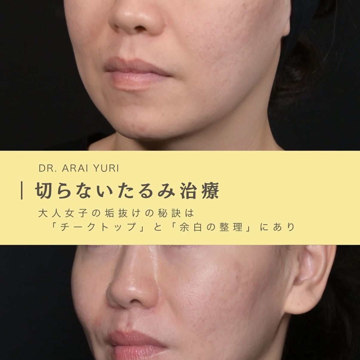 複合施術