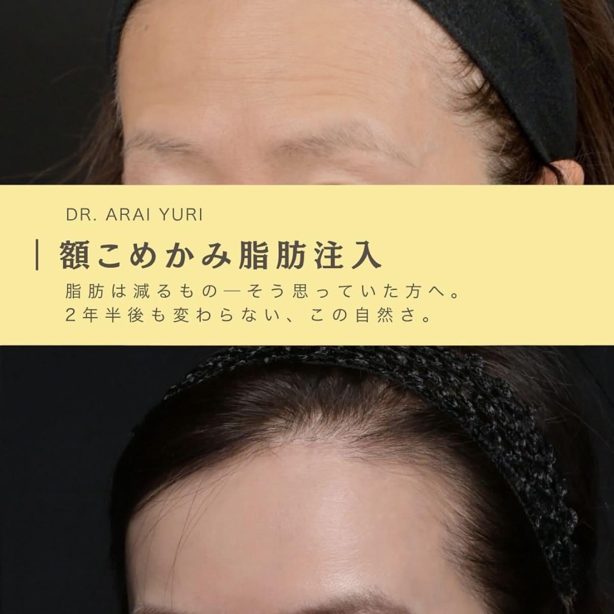 複合施術