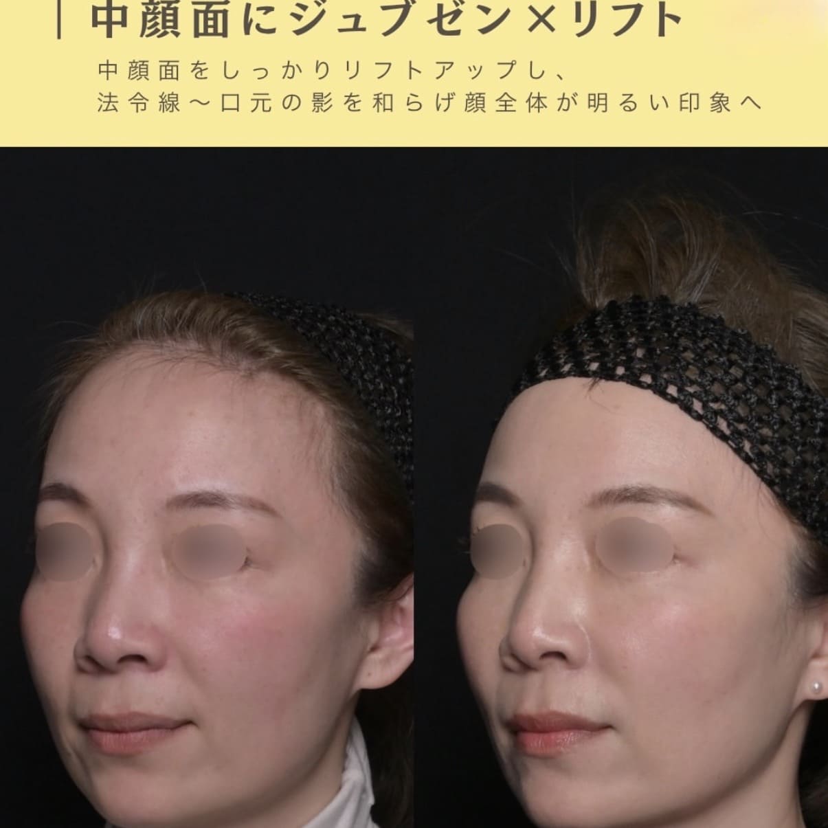 複合施術
