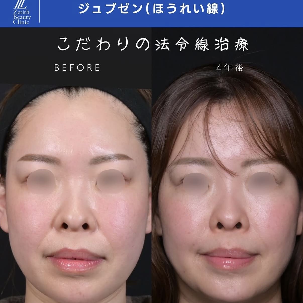 複合施術