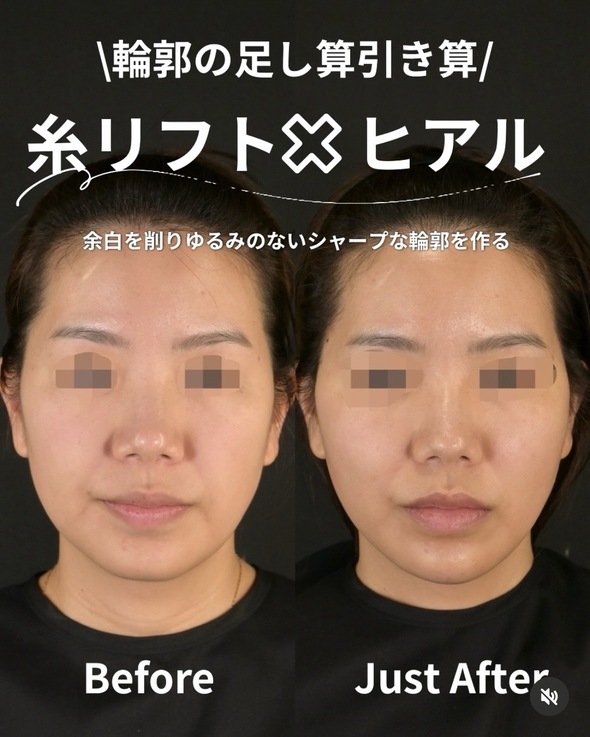 複合施術