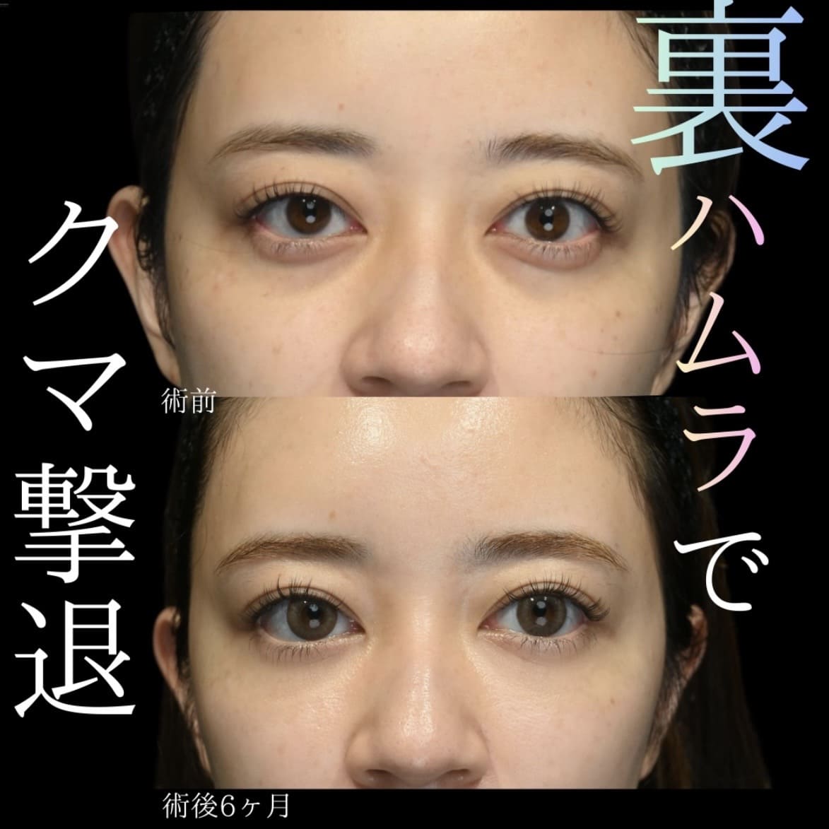 クマ治療