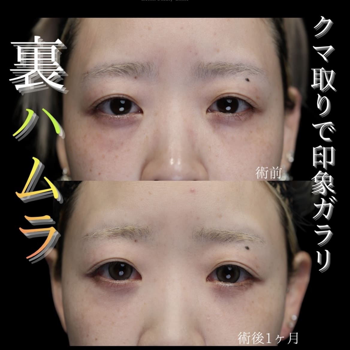 クマ治療