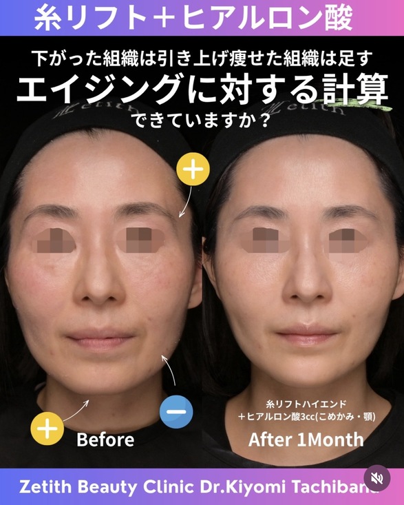 複合施術