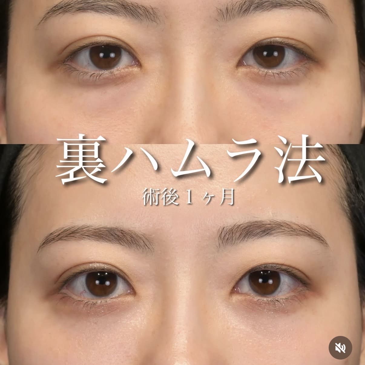 裏ハムラ